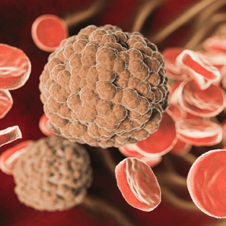 Kanker Darah: Penyebab, Gejala, dan Penanganannya